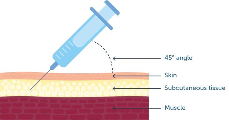 Subcutaneous injection diagram